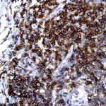 Lambda Light chain Antibody in Immunohistochemistry (Paraffin) (IHC (P))