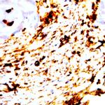 Neurofilaments (200kDa/68kDa) Antibody in Immunohistochemistry (Paraffin) (IHC (P))