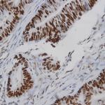 p53 Antibody in Immunohistochemistry (PFA fixed) (IHC (PFA))