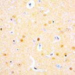 Somatostatin Antibody in Immunohistochemistry (Paraffin) (IHC (P))