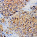 Synaptophysin Antibody in Immunohistochemistry (Paraffin) (IHC (P))