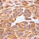 Caspase 8 Antibody in Immunohistochemistry (Paraffin) (IHC (P))