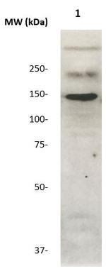 c-erbB-2 Antibody in Western Blot (WB)