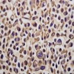 EGFR Antibody in Immunocytochemistry (ICC/IF)