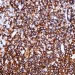 CD5 Antibody in Immunohistochemistry (Paraffin) (IHC (P))