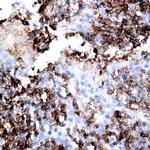 p27/Kip Antibody in Immunohistochemistry (Paraffin) (IHC (P))