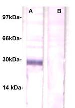 p27/Kip Antibody in Western Blot (WB)