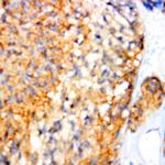 c-erbB-4 Antibody in Immunohistochemistry (Paraffin) (IHC (P))