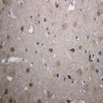 Synuclein beta Antibody in Immunohistochemistry (Paraffin) (IHC (P))