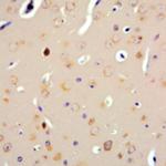 Parathyroid Hormone (PTH) Antibody in Immunohistochemistry (Paraffin) (IHC (P))