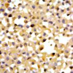 Cathepsin D Antibody in Immunocytochemistry (ICC/IF)