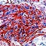 GLUT-1 Antibody in Immunohistochemistry (Paraffin) (IHC (P))