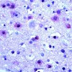 mGluR5 Antibody in Immunohistochemistry (Paraffin) (IHC (P))