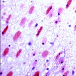 GluR6/7 Antibody in Immunohistochemistry (Paraffin) (IHC (P))