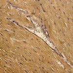 Myoglobin Antibody in Immunohistochemistry (Paraffin) (IHC (P))