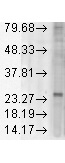 KDEL Receptor Antibody in Western Blot (WB)