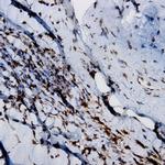 CD23 Antibody in Immunohistochemistry (Paraffin) (IHC (P))