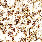 CD2 Antibody in Immunohistochemistry (Paraffin) (IHC (P))