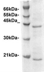CD3 zeta Antibody in Western Blot (WB)