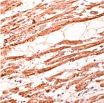 Troponin T Antibody in Immunohistochemistry (Paraffin) (IHC (P))