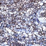 CD38 Antibody in Immunohistochemistry (Paraffin) (IHC (P))