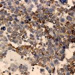 GLUT-3 Antibody in Immunohistochemistry (Paraffin) (IHC (P))