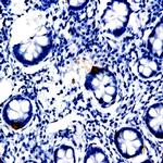 Osteopontin Antibody in Immunohistochemistry (Paraffin) (IHC (P))