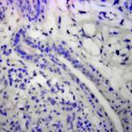 Bak Antibody in Immunohistochemistry (Paraffin) (IHC (P))