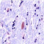 Ubiquitin Antibody in Immunohistochemistry (Paraffin) (IHC (P))