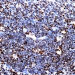 CD99 Antibody in Immunohistochemistry (Paraffin) (IHC (P))