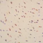 Amyloid beta Antibody in Immunohistochemistry (Paraffin) (IHC (P))