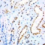 Cyclin E Antibody in Immunohistochemistry (Paraffin) (IHC (P))