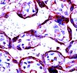 MMP-2 Antibody in Immunohistochemistry (Paraffin) (IHC (P))