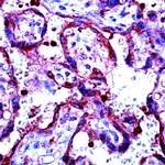 MMP-9 Antibody in Immunohistochemistry (Paraffin) (IHC (P))