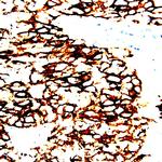 Catenin gamma Antibody in Immunohistochemistry (Paraffin) (IHC (P))
