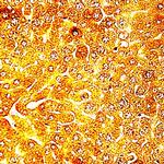 a-B-Crystallin Antibody in Immunohistochemistry (Paraffin) (IHC (P))