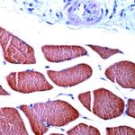 Actin, Skeletal Muscle Antibody in Immunohistochemistry (Paraffin) (IHC (P))