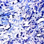 MMP-19 Antibody in Immunohistochemistry (Paraffin) (IHC (P))
