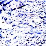 MMP-23 Antibody in Immunohistochemistry (Paraffin) (IHC (P))