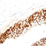 Cyclin B1 Antibody in Immunohistochemistry (Paraffin) (IHC (P))