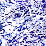MMP-15 Antibody in Immunohistochemistry (Paraffin) (IHC (P))