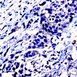 CD105 Antibody in Immunohistochemistry (Paraffin) (IHC (P))