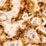 Retinoblastoma (RB) Antibody in Immunohistochemistry (Paraffin) (IHC (P))