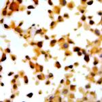 p14ARF Antibody in Immunocytochemistry (ICC/IF)