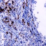 IFN gamma Antibody in Immunohistochemistry (Paraffin) (IHC (P))