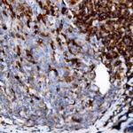 CD34 Antibody in Immunohistochemistry (Paraffin) (IHC (P))