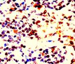 BCL-2 Antibody in Immunohistochemistry (Paraffin) (IHC (P))