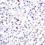 MMP-16/MT3-MMP Antibody in Immunocytochemistry (ICC/IF)