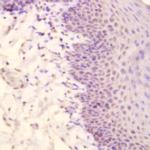 Myosin Heavy Chain, (Smooth Muscle) Antibody in Immunohistochemistry (Paraffin) (IHC (P))