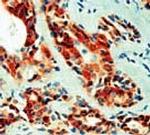 Vacular Endothelial Growth Factor (VEGF) Antibody in Immunohistochemistry (Paraffin) (IHC (P))